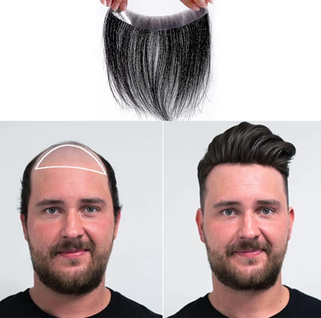 hair systems for men 